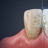 Professional teeth whitening treatment in Ahmedabad by Dr. Jay Kothari