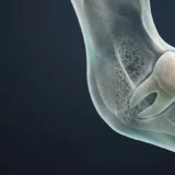 A high-end 3D medical visualization of a translucent lower jawbone showing a horizontally impacted lower third molar (wisdom tooth) positioned against the second molar. The background is a clean, dark navy and charcoal gradient with subtle teal accents.